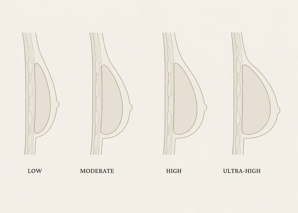Which breast implant profile is right for you?
