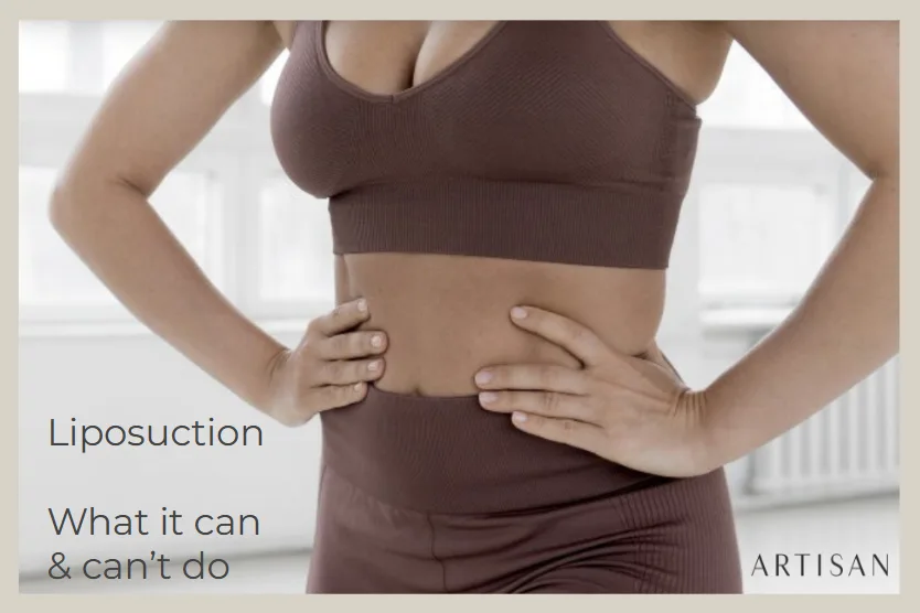 Stomach Liposuction: What It Can and Can't Do for Belly Fat