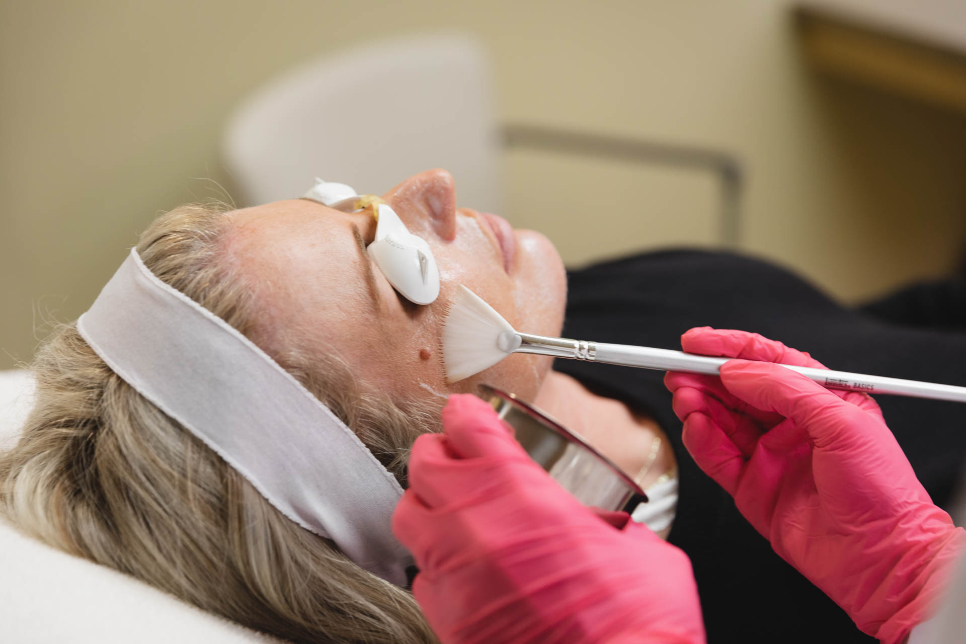 Young woman layns on a treatment table with her eyes protected as an Aristan provider use a brush to apply chemical peel solutions. This is part of the patient's face rejuvenation treatment in Atlanta.