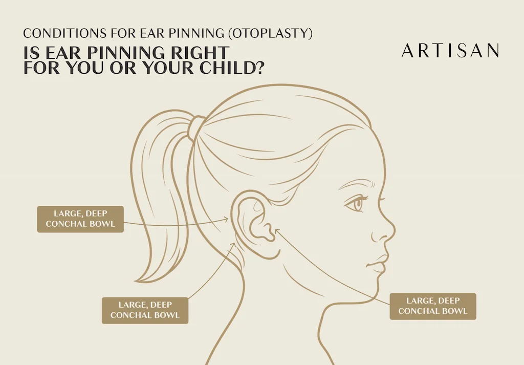 Are you or your child a good candidate for ear pinning surgery?