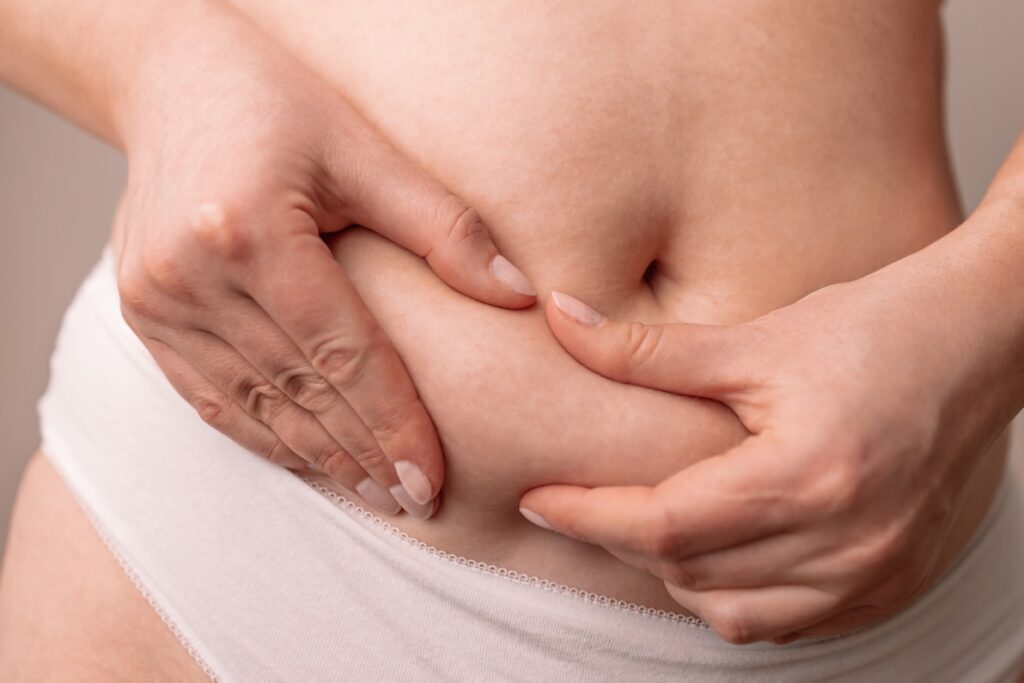 a close up image of a woman pinching her fat while considering a belly tuck in Atlanta.