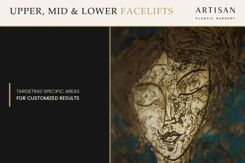 Upper Face Lift, Midface or Lower Lift: Which One Fits You?
